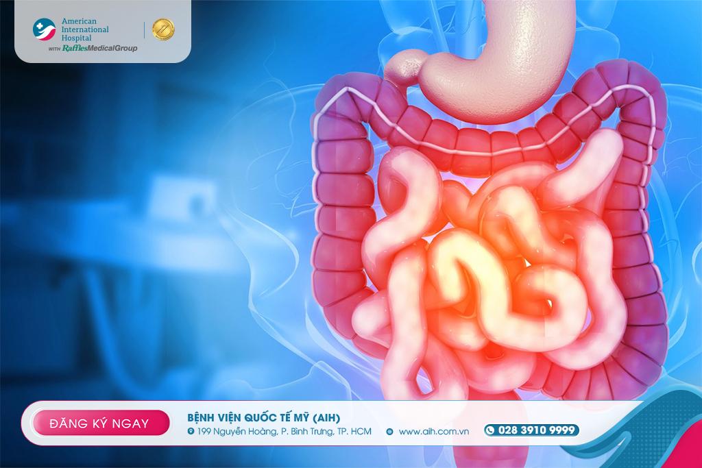 HỘI CHỨNG RUỘT KÍCH THÍCH GÂY ĐAU BỤNG, RỐI LOẠN TIÊU HÓA & ẢNH HƯỞNG TINH THẦN