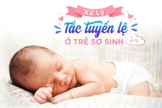 XỬ LÝ TẮC TUYẾN LỆ Ở TRẺ SƠ SINH