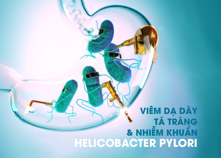 VIÊM DẠ DÀY – TÁ TRÀNG VÀ NHIỄM KHUẨN HELICOBACTER PYLORI