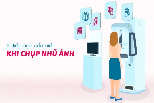 5 ĐIỀU BẠN CẦN BIẾT KHI CHỤP NHŨ ẢNH
