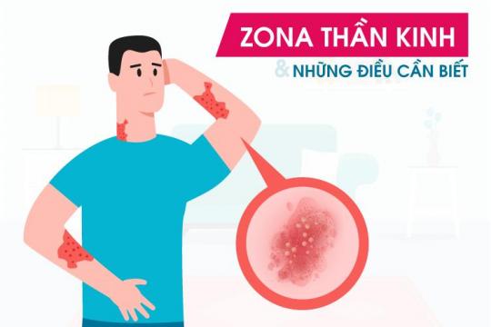 ZONA THẦN KINH & NHỮNG ĐIỀU CẦN BIẾT