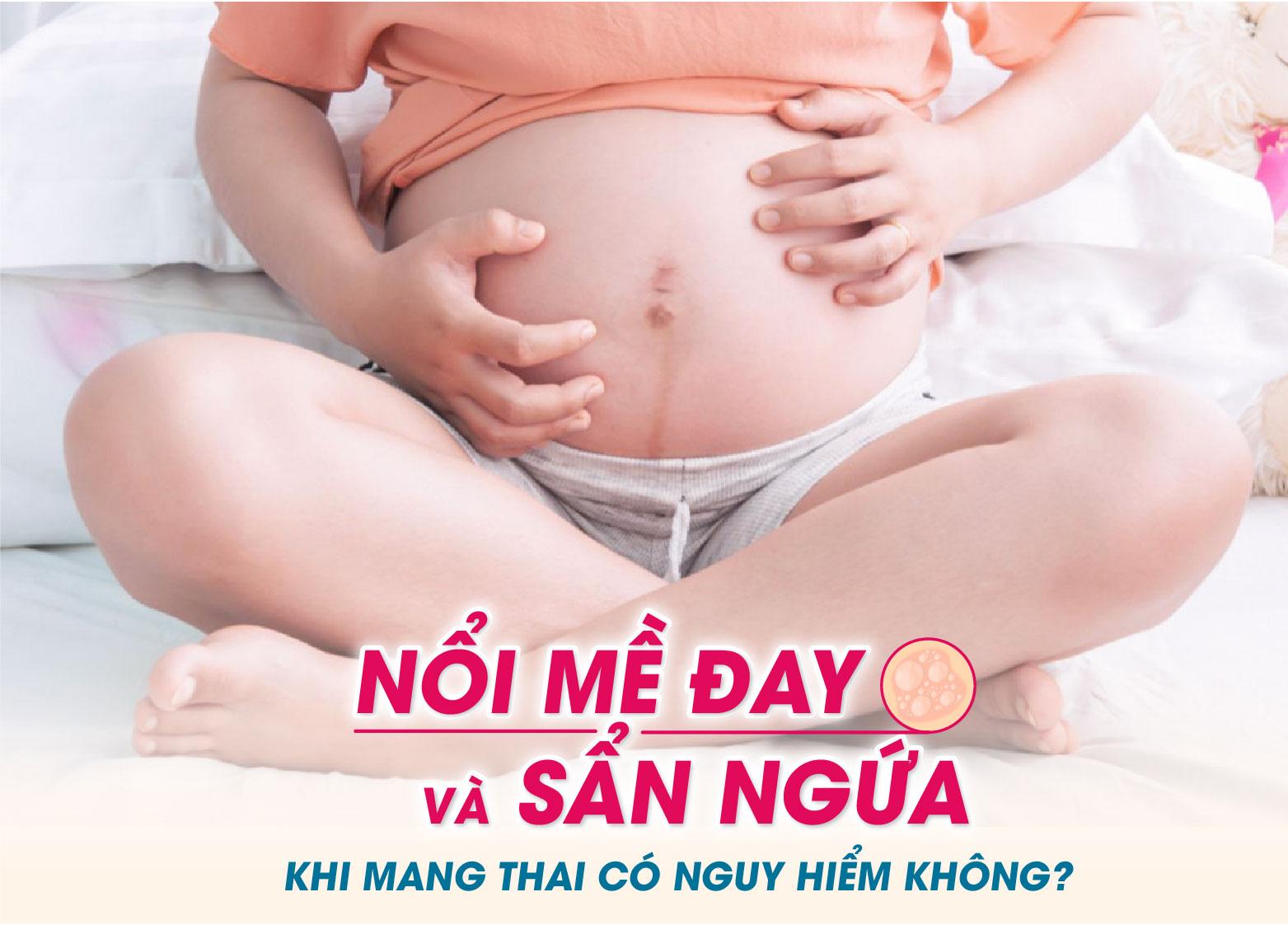 MẸ BẦU BỊ NỔI MỀ ĐAY VÀ SẨN NGỨA KHI MANG THAI CÓ NGUY HIỂM KHÔNG?