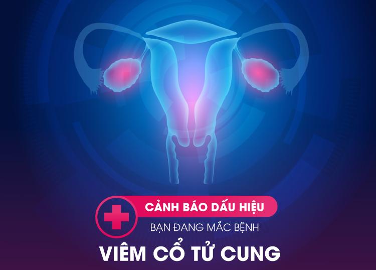 CẢNH BÁO DẤU HIỆU BẠN ĐANG MẮC BỆNH VIÊM CỔ TỬ CUNG