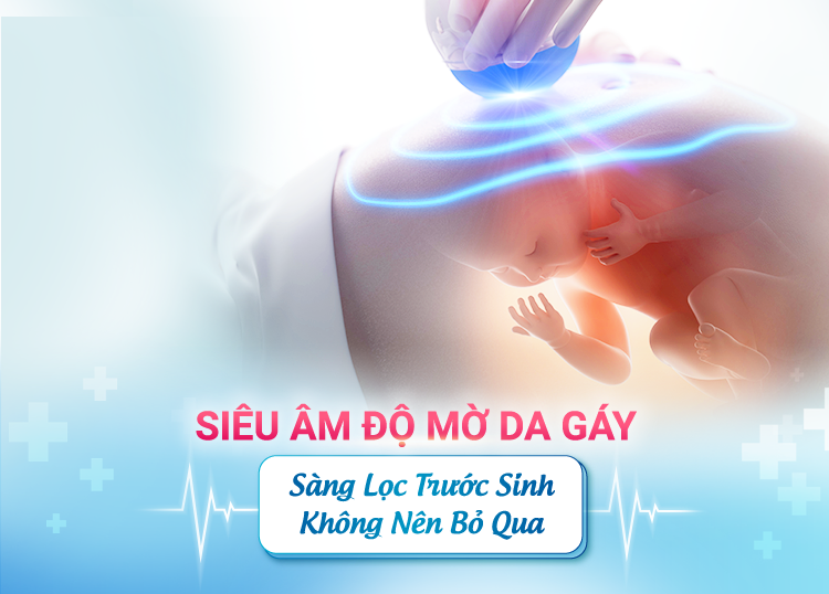 SIÊU ÂM ĐỘ MỜ DA GÁY – SÀNG LỌC TRƯỚC SINH MẸ KHÔNG NÊN BỎ QUA