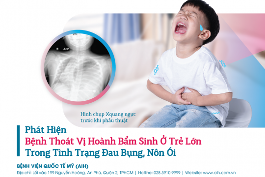 BỆNH THOÁT VỊ HOÀNH BẨM SINH HIẾM GẶP Ở TRẺ LỚN