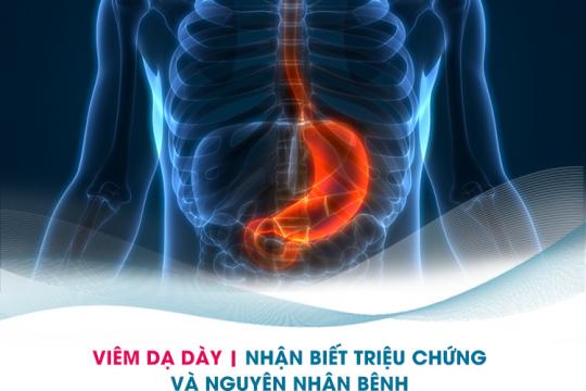 Viêm Dạ Dày – Triệu Chứng, Nguyên Nhân và Cách Điều Trị
