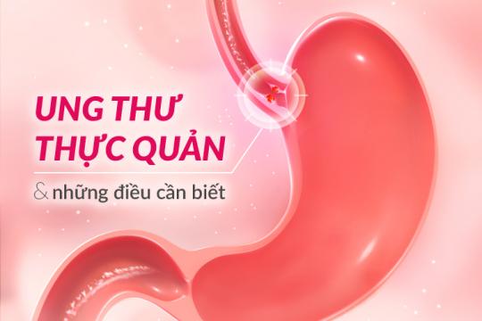UNG THƯ THỰC QUẢN & NHỮNG ĐIỀU CẦN BIẾT