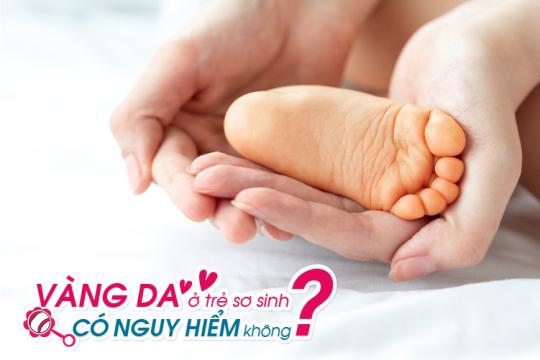 VÀNG DA Ở TRẺ SƠ SINH CÓ NGUY HIỂM KHÔNG?