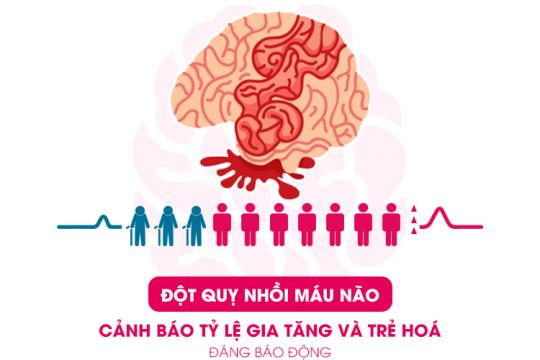 ĐỘT QUỴ NHỒI MÁU NÃO | CẢNH BÁO TỈ LỆ GIA TĂNG VÀ TRẺ HOÁ ĐÁNG BÁO ĐỘNG