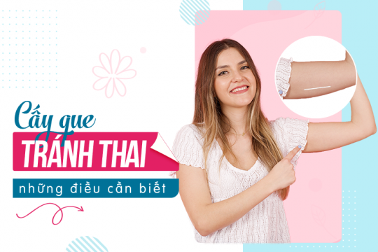 CẤY QUE TRÁNH THAI: NHỮNG ĐIỀU CẦN BIẾT