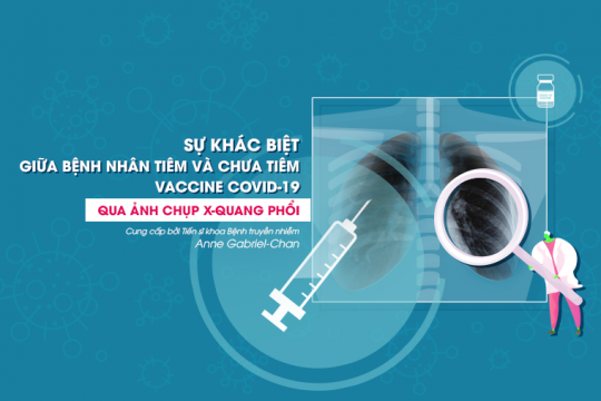 SỰ KHÁC BIỆT GIỮA BỆNH NHÂN TIÊM VÀ CHƯA TIÊM VACCINE COVID-19 QUA ẢNH CHỤP X-QUANG PHỔI