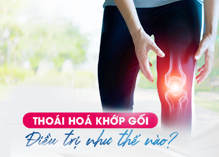 ĐỪNG ĐỂ THOÁI HOÁ KHỚP GỐI CẢN TRỞ CUỘC SỐNG CỦA BẠN!