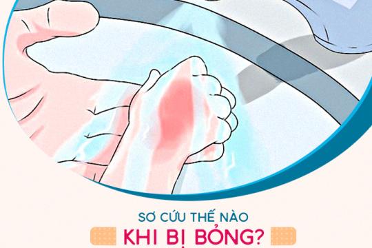 SƠ CỨU THẾ NÀO KHI BỊ BỎNG?