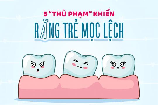 5 “THỦ PHẠM” KHIẾN RĂNG TRẺ MỌC LỆCH