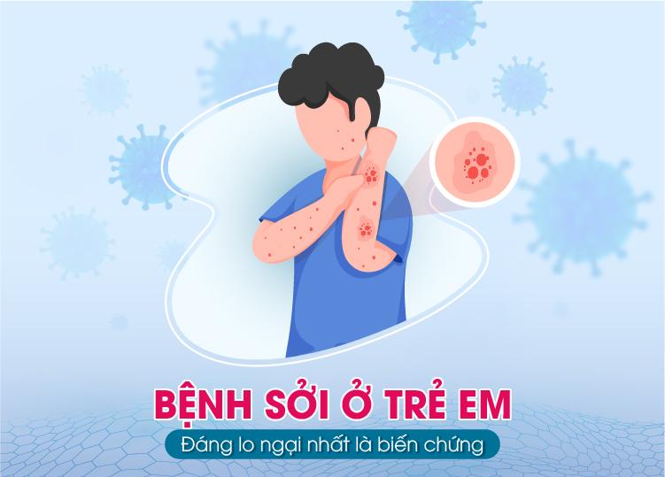 BỆNH SỞI Ở TRẺ EM | ĐÁNG LO NGẠI NHẤT LÀ BIẾN CHỨNG