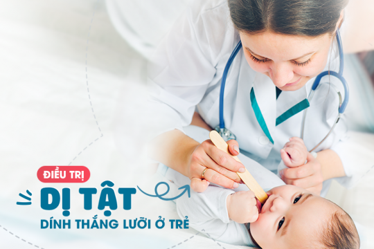 ĐIỀU TRỊ DÍNH THẮNG LƯỠI Ở TRẺ