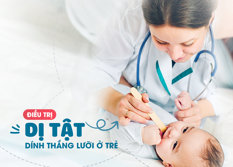 ĐIỀU TRỊ DÍNH THẮNG LƯỠI Ở TRẺ