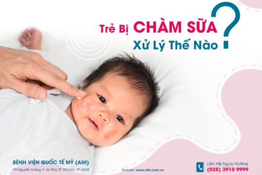 TRẺ BỊ CHÀM SỮA, XỬ LÝ THẾ NÀO?​