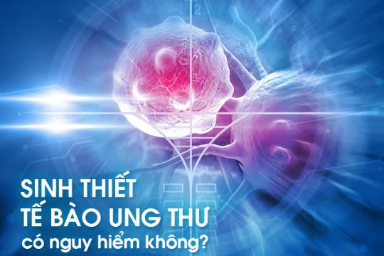 SINH THIẾT XÁC ĐỊNH TẾ BÀO UNG THƯ CÓ NGUY HIỂM KHÔNG?