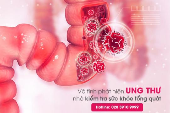 VÔ TÌNH PHÁT HIỆN UNG THƯ GIAI ĐOẠN SỚM NHỜ KIỂM TRA SỨC KHỎE TỔNG QUÁT!