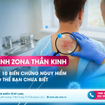 BỆNH ZONA THẦN KINH VÀ 10 BIẾN CHỨNG NGUY HIỂM CÓ THỂ BẠN CHƯA BIẾT
